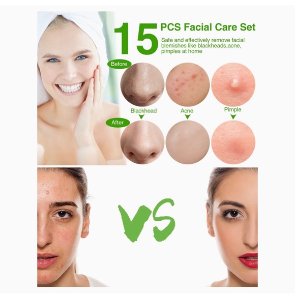 15 Pcs Pimple Popper Tool Kit,Blackhead Extractor Tool for Comedones - Picture 2 of 9